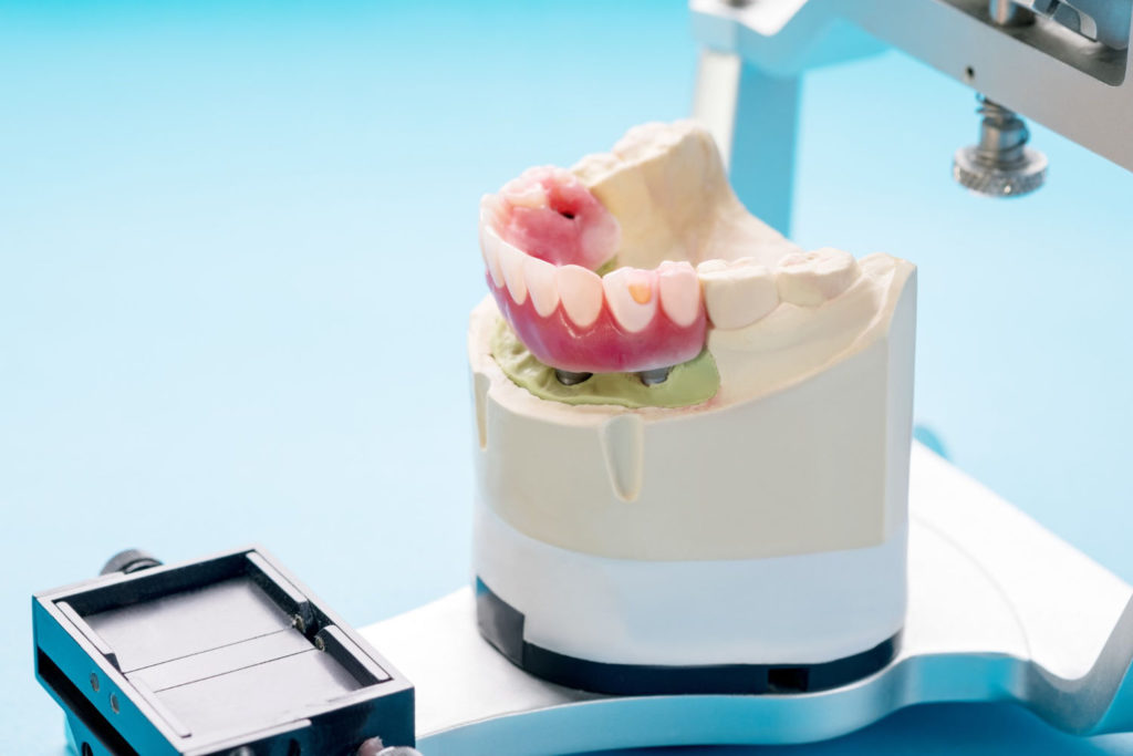 Protetyka stomatologiczna jest bardzo specyficzną dziedziną stomatologii, która pomaga wtedy, kiedy na profilaktykę i leczenie uszkodzonych zębów jest już zwyczajnie za późno